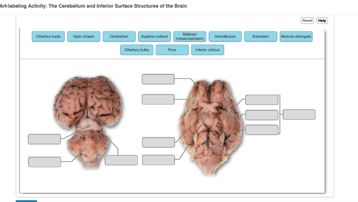 Art-labeling activity: internal midsagittal view of the skull