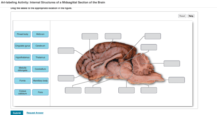 Art-labeling activity: internal midsagittal view of the skull